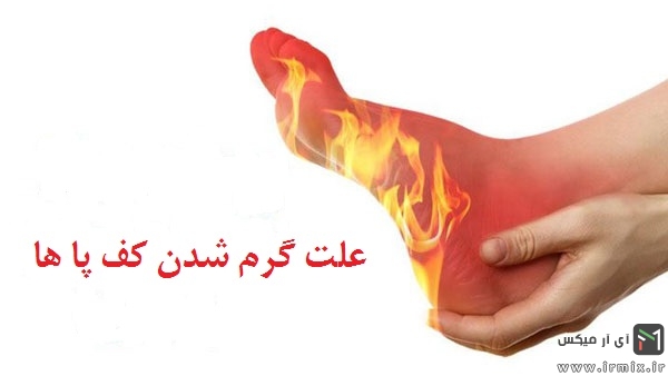 علت گرم شدن کف پا