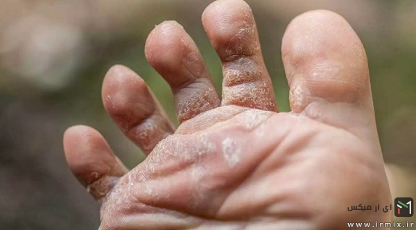 پای ورزشکار