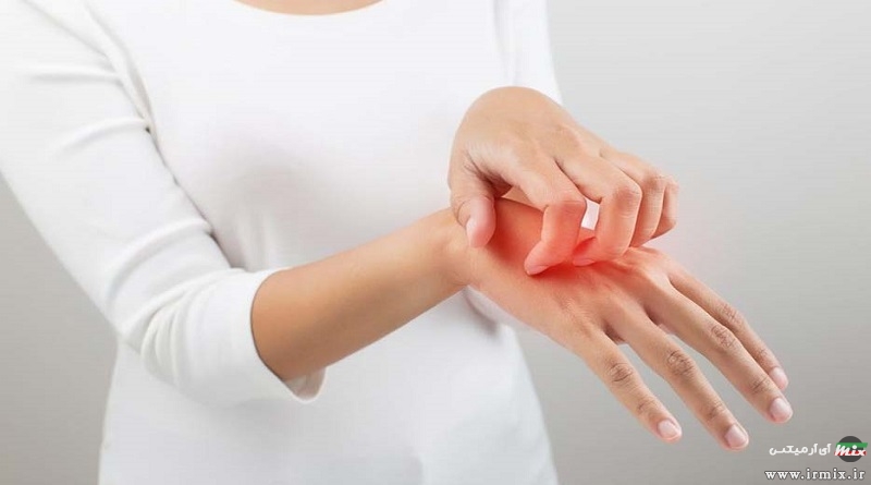 خارش بدن نشانه چیست؟ معرفی درمان های خانگی و گیاهی برای خارش پوست